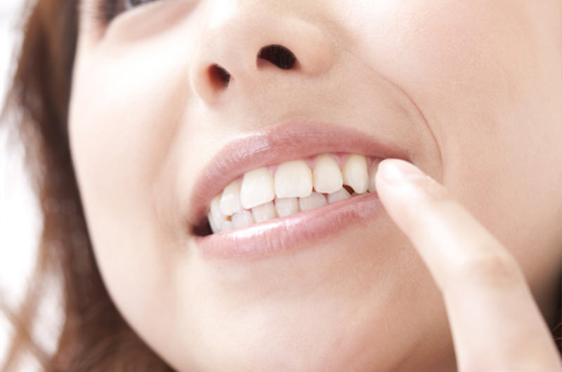 噛み合わせについて