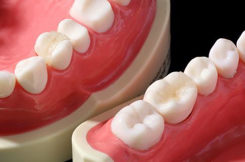 e-max（イーマックス）