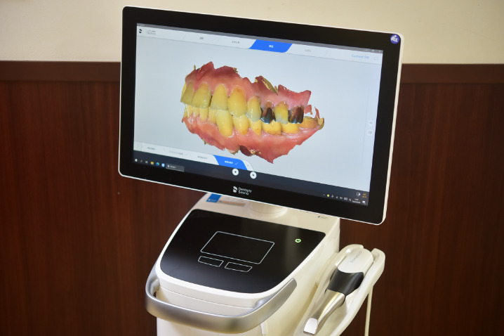 プライムスキャン